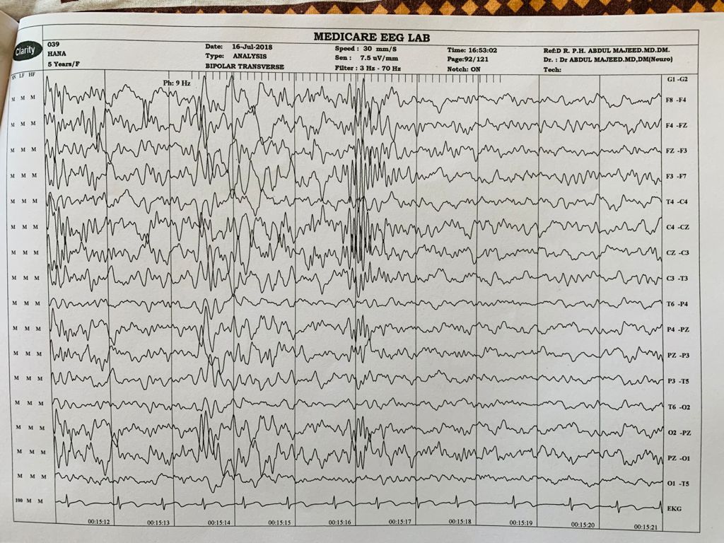 Patient Story