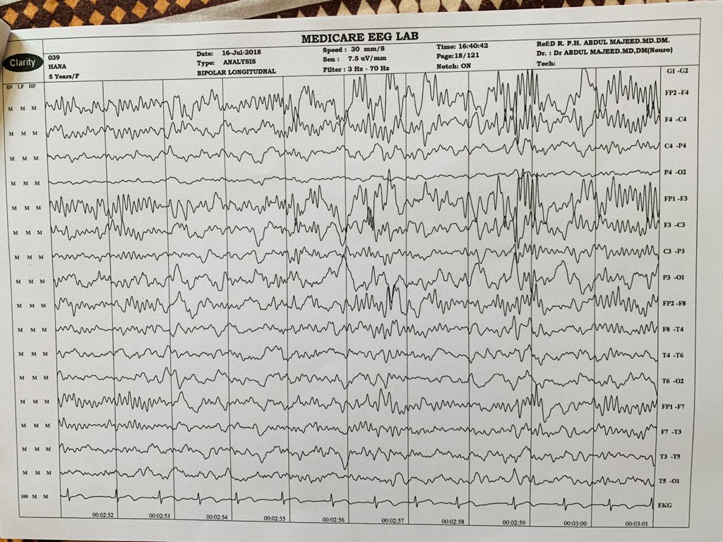 Patient Story
