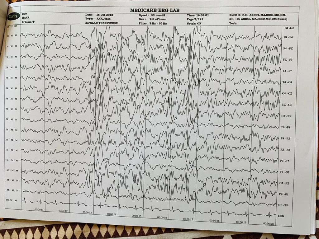 Patient Story