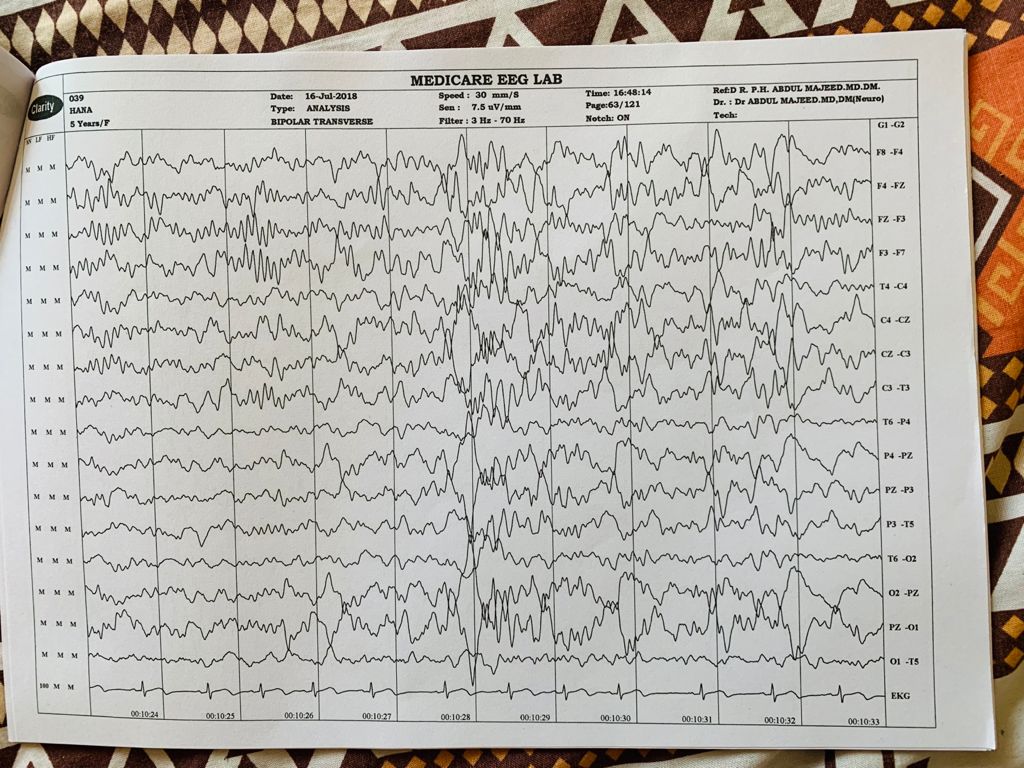 Patient Story