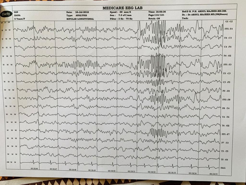Patient Story