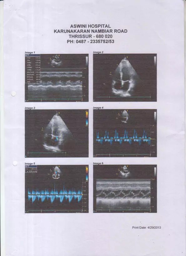 Patient Story