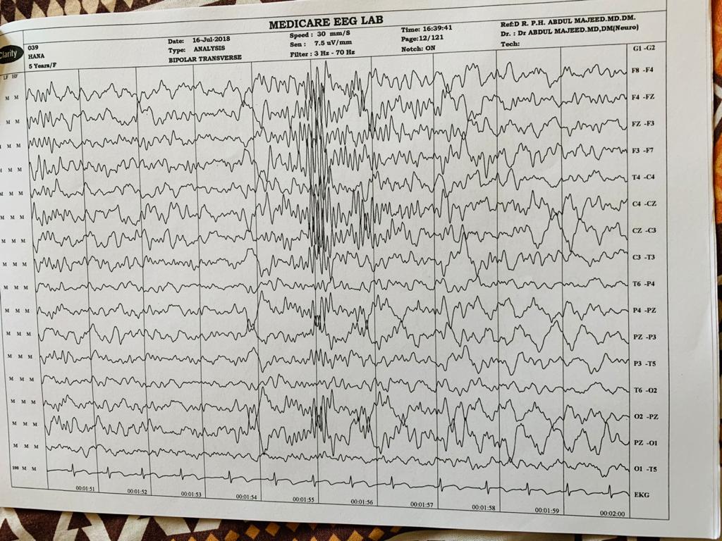 Patient Story