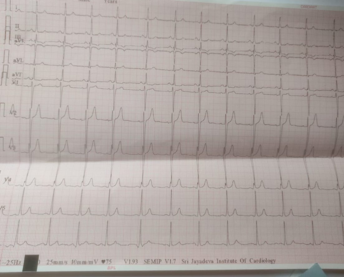Patient Story