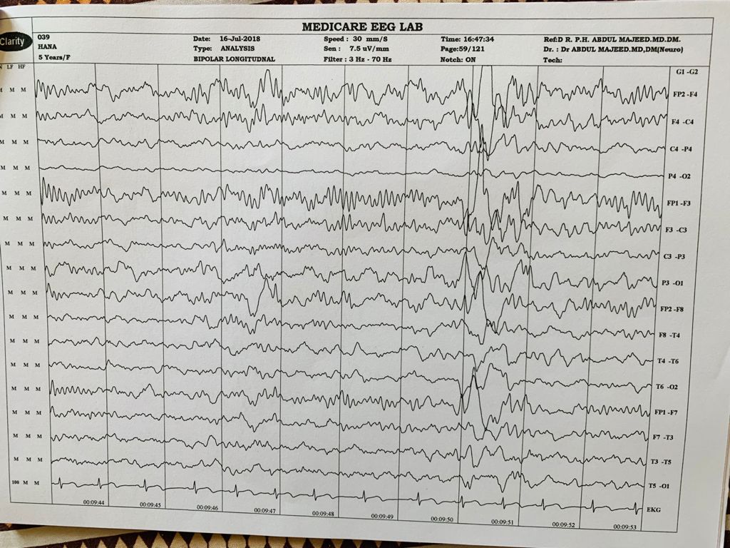 Patient Story