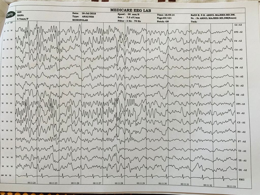Patient Story