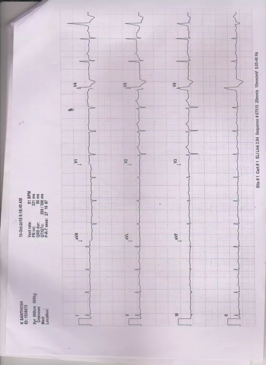 Patient Story