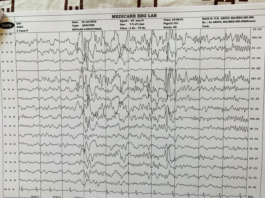 Patient Story