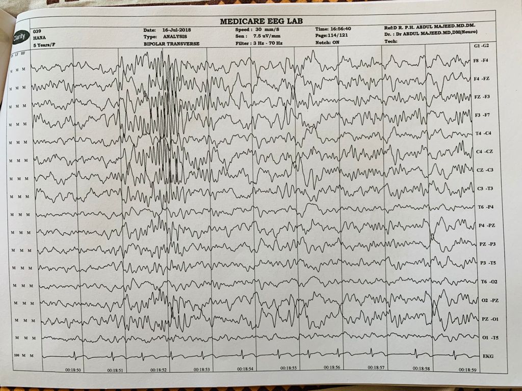 Patient Story