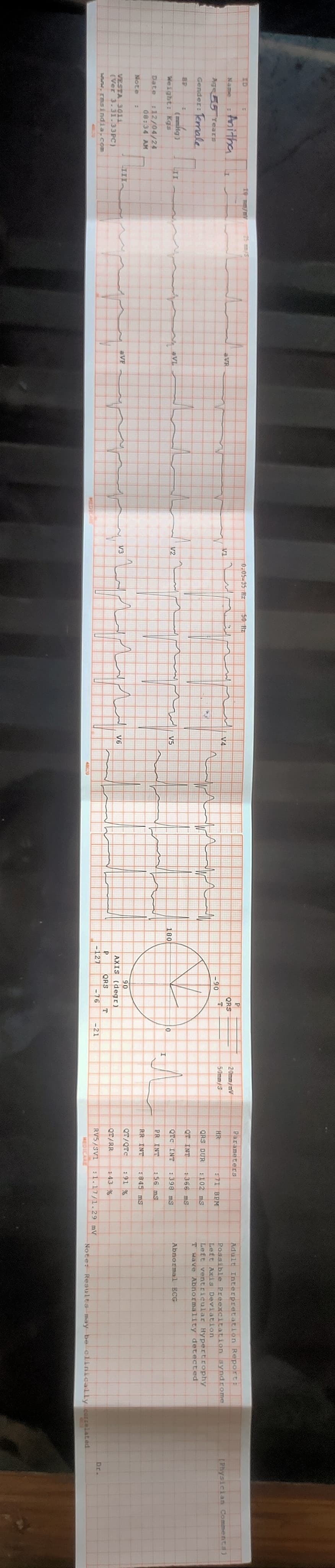 Patient Story