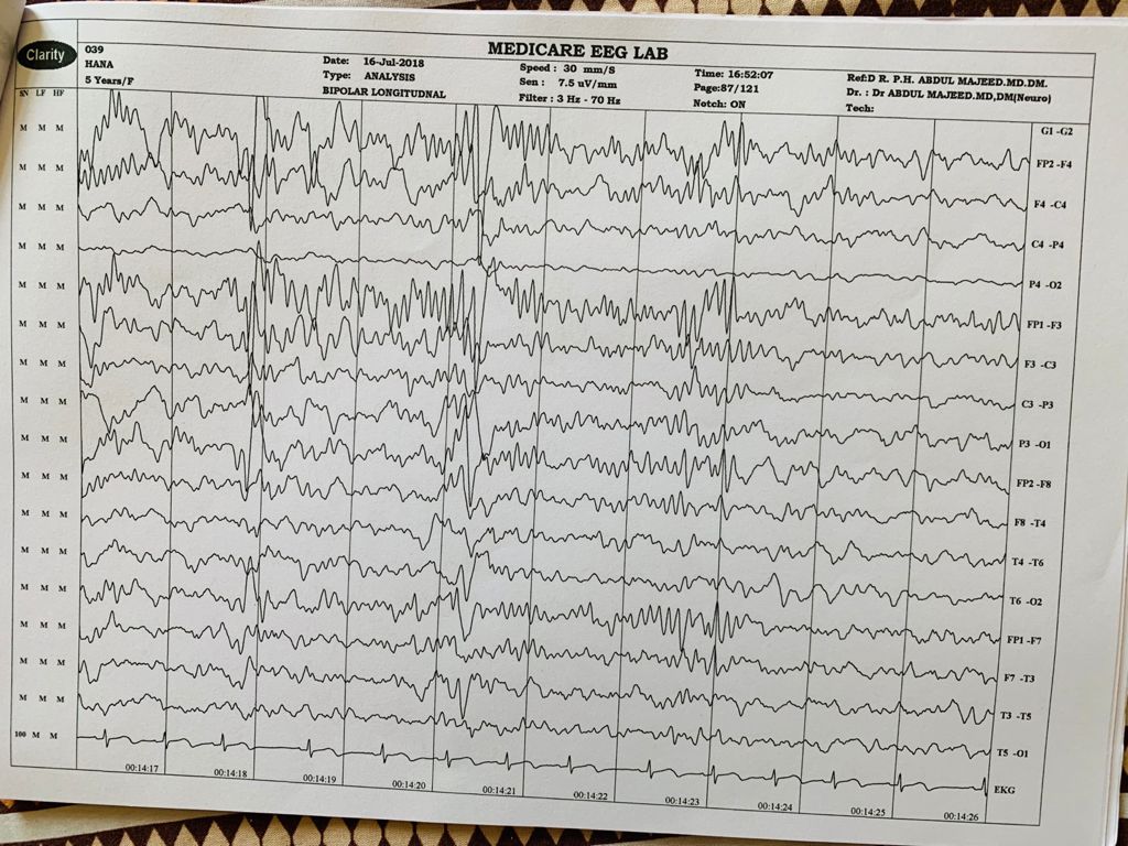 Patient Story